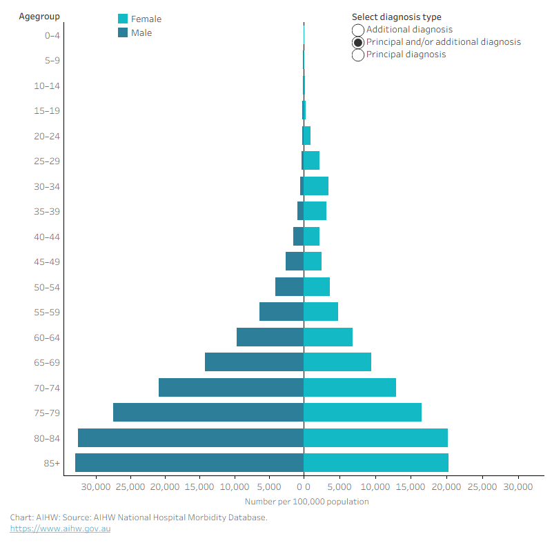 The chart shows rates for diabetes as the principal diagnosis increased with age and were highest in those aged 85 and over for both males and females. 
