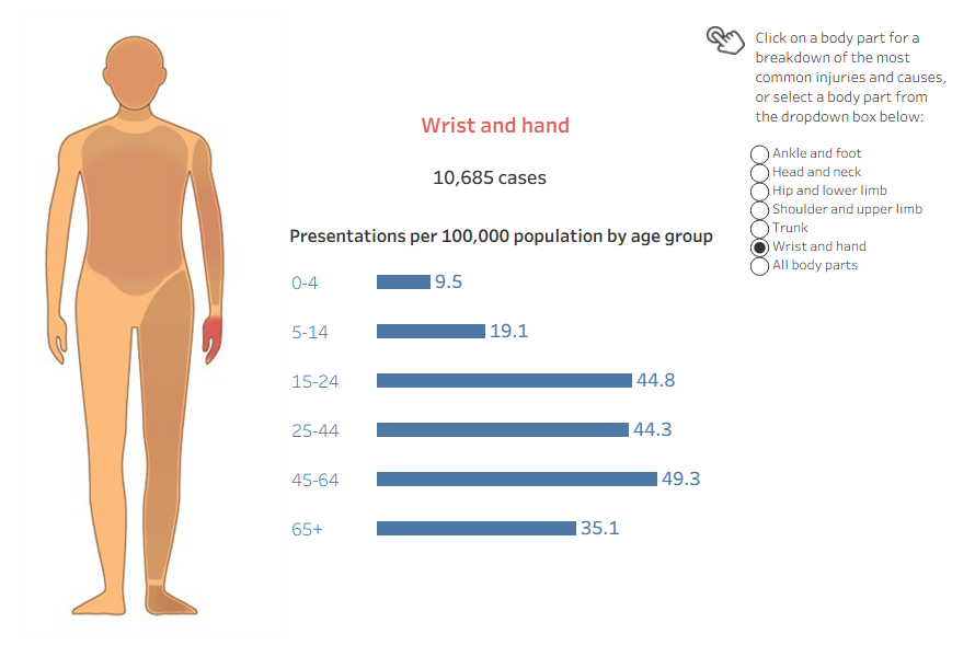 An interactive tableau visualisation showing human figure with injury hospitalisation data for each body part. The wrist and hand reported the highest number of injury cases.