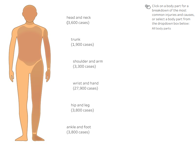 This is a diagram of body parts injured by contact with objects, and the associated object types. About 3 in 5 injuries from contact with objects affected hands and wrists.